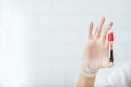 The Power of Prevention: Why Yearly Blood Tests Are Essential