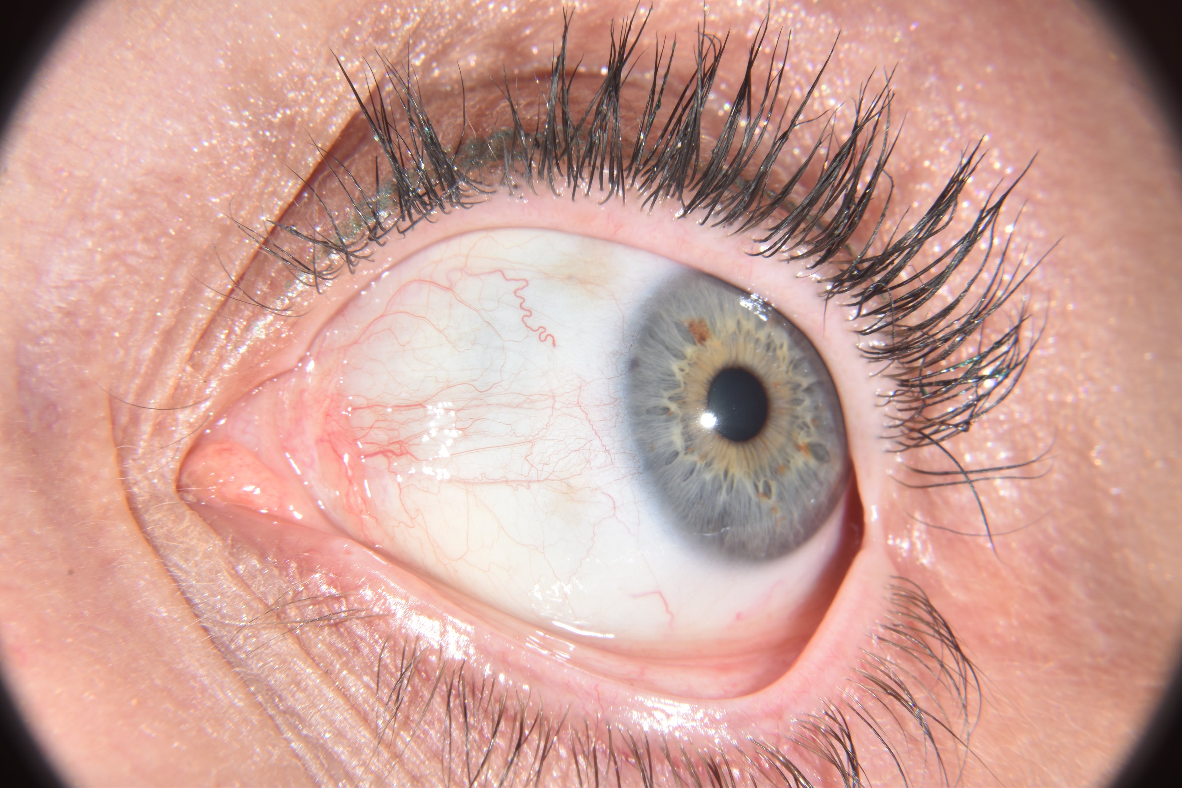 Close-up of a human eye with a clear sclera.