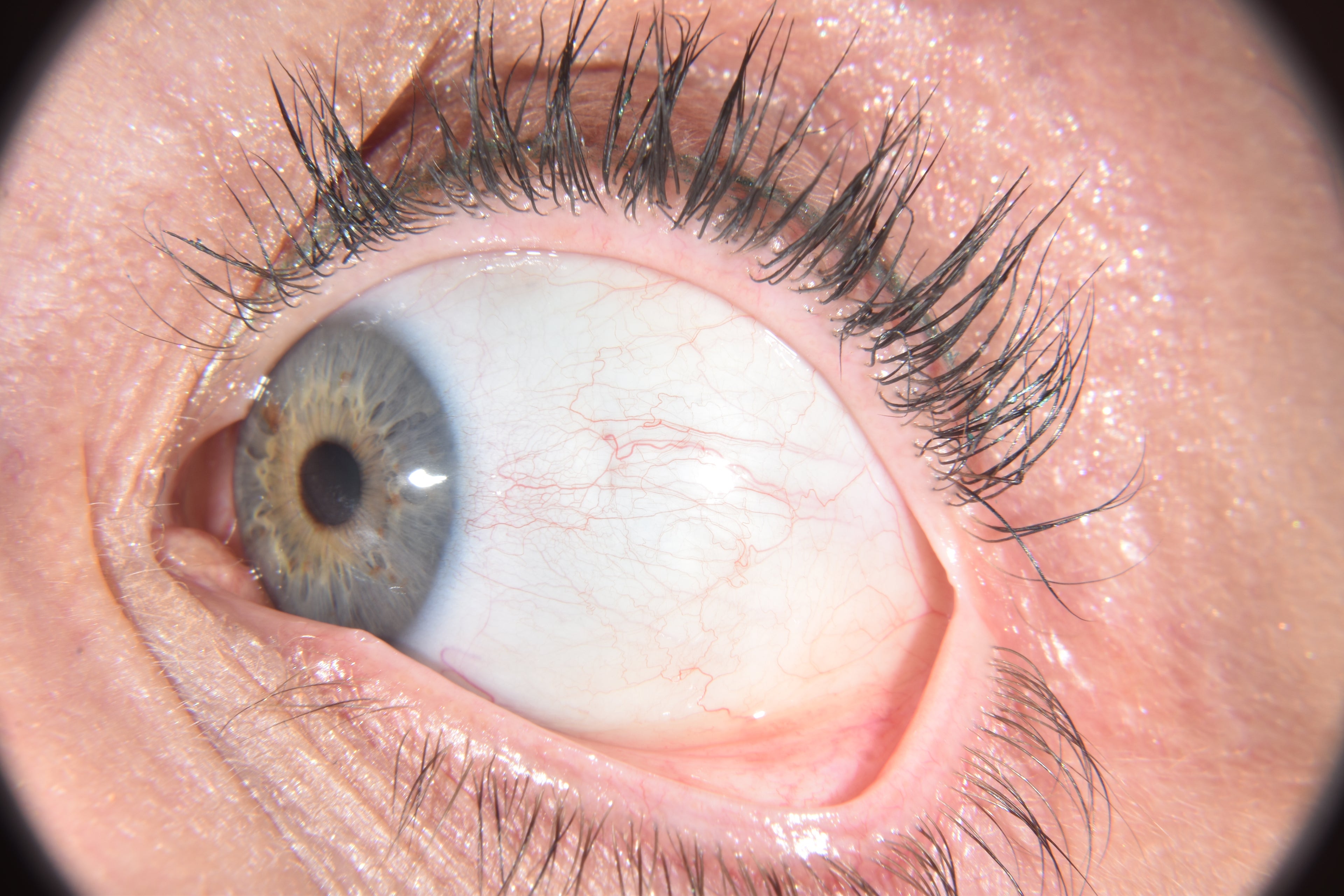 Close-up of a human eye with detailed view of the iris and sclera.