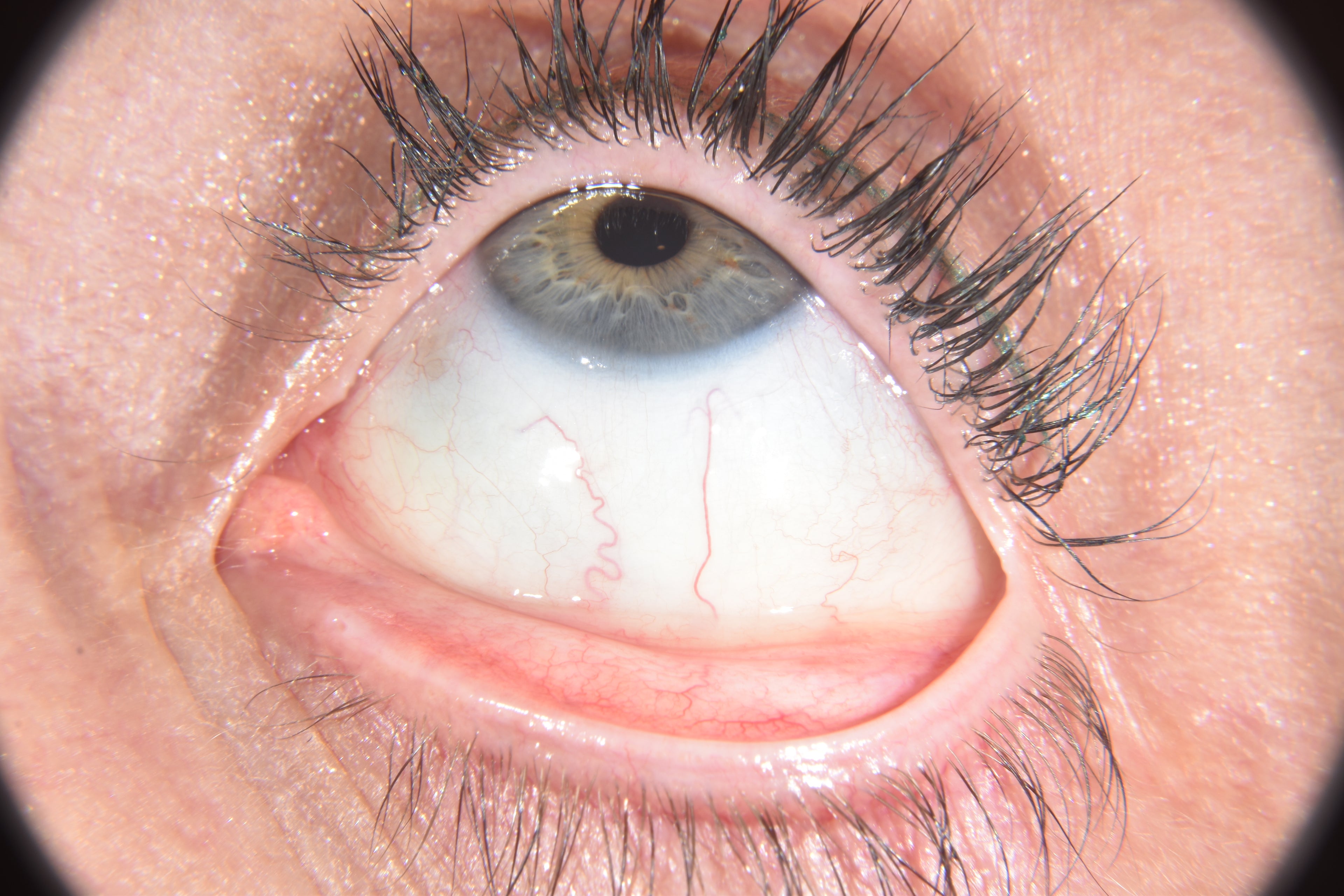 Close-up of a human eye with detailed view of iris and sclera.