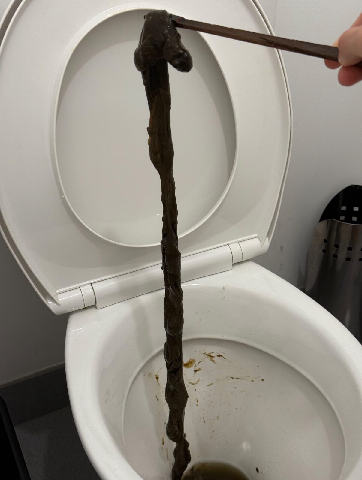 A mucosal plaque rope that has been expelled from the body as part of Renew Health Co.'s bowel cleansing protocol.