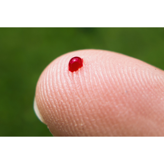 This exclusive add-on allows you to convert any one of your Power Pack sessions into a Live Blood Analysis appointment – one of our most powerful tools for assessing your inner health in real time.