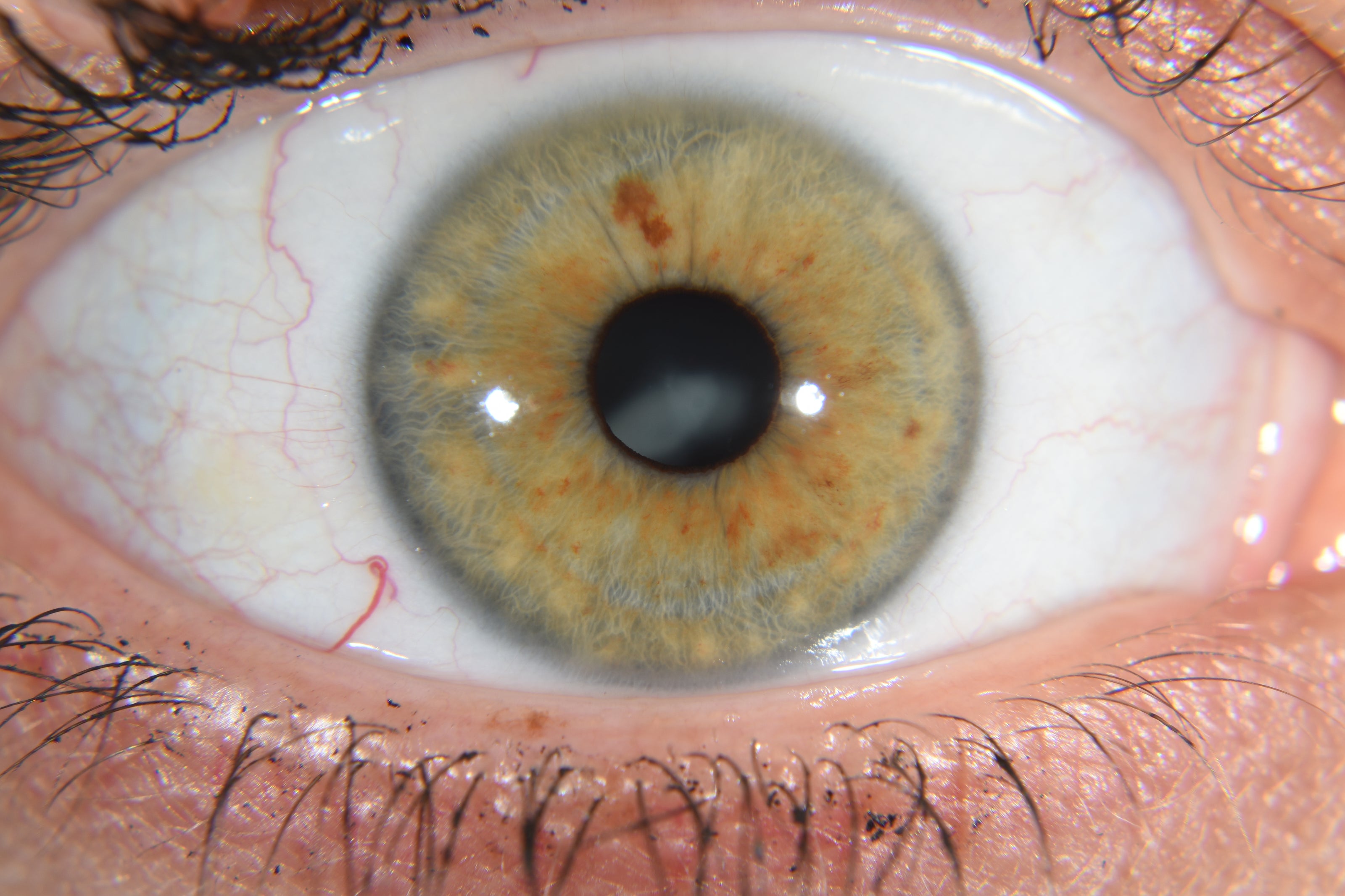 Close-up of a human eye with a detailed view of the iris and pupil.