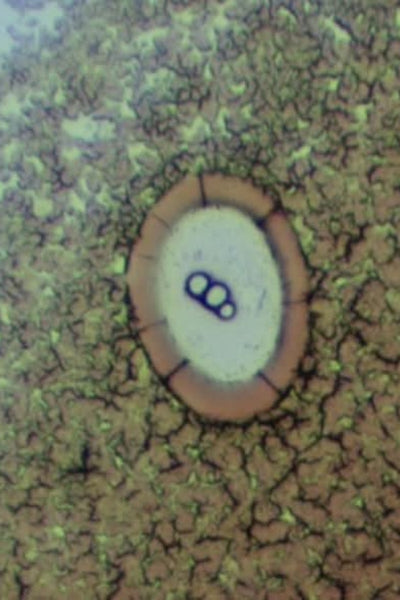 Microscopic view of a dry blood sample