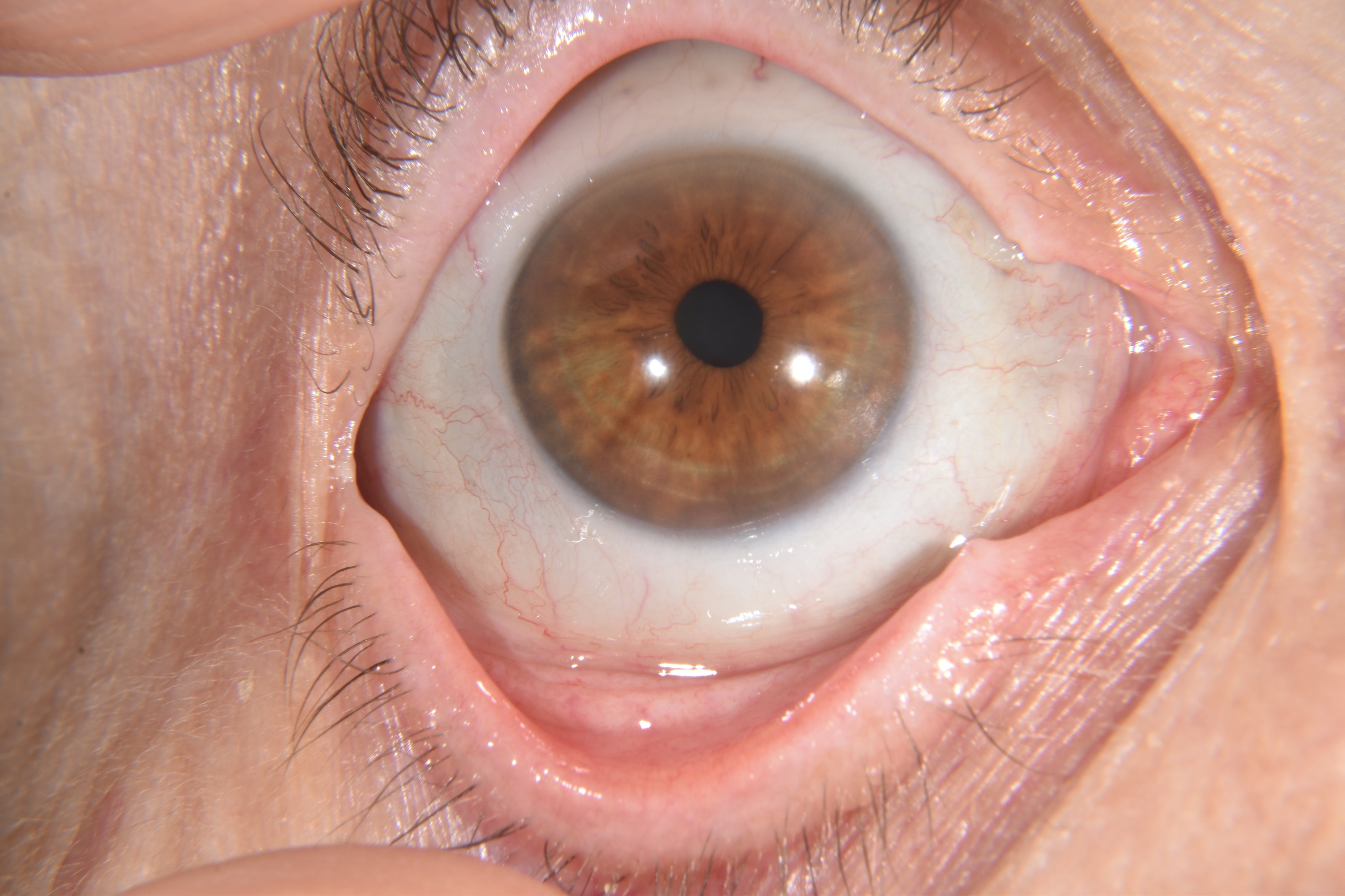 Close-up of a brown eye with detailed view of the iris and sclera.