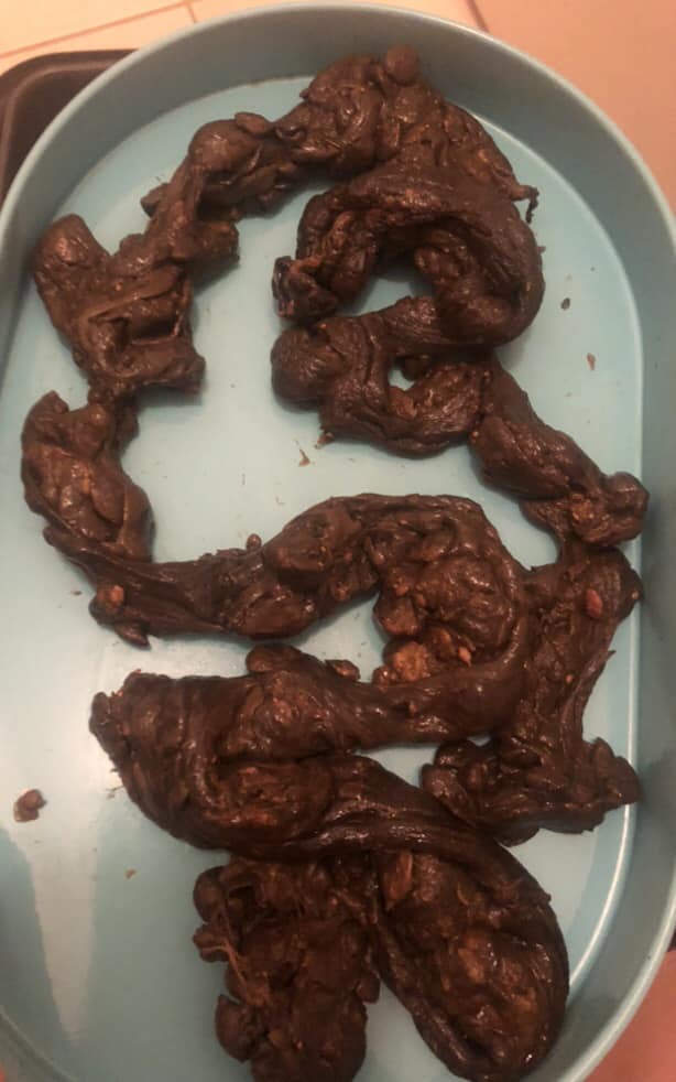 Mucosal plaque that has been released from someone bowel as part of the Renew Health Co. cleansing protocol. 