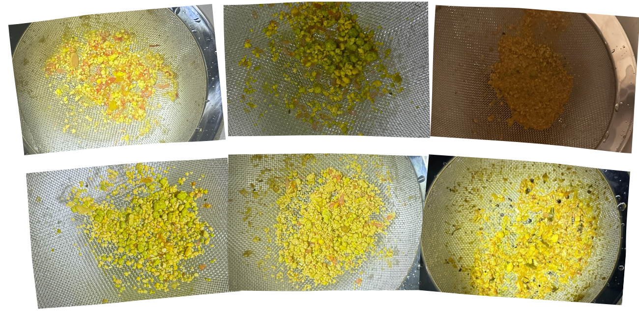 Photo of liver stones from a man in his 50s with no gallbladder. 